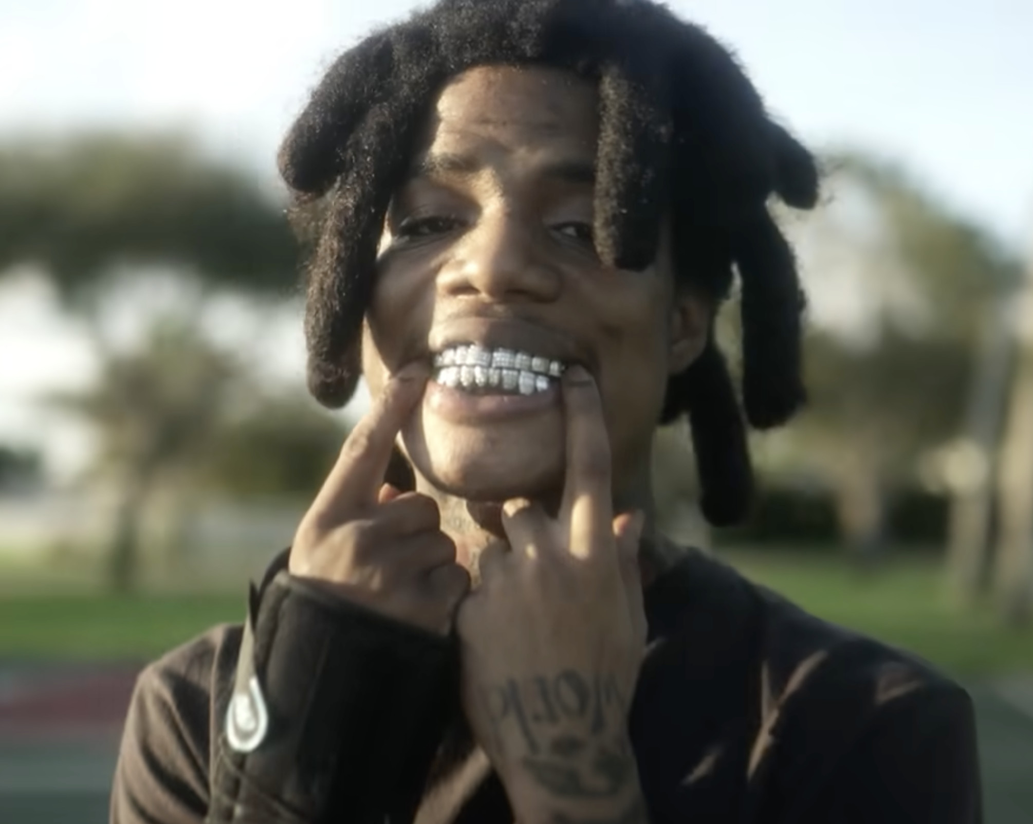 A person with dreadlocks showing off diamond grills in their teeth, smiling outdoors.